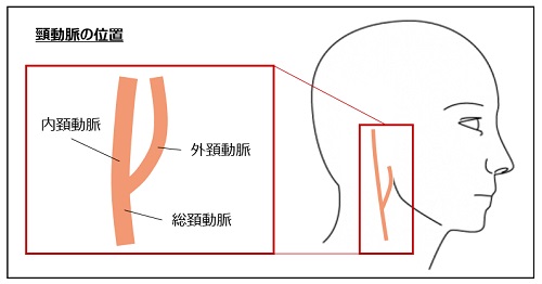 頸 動脈 押す と 痛い